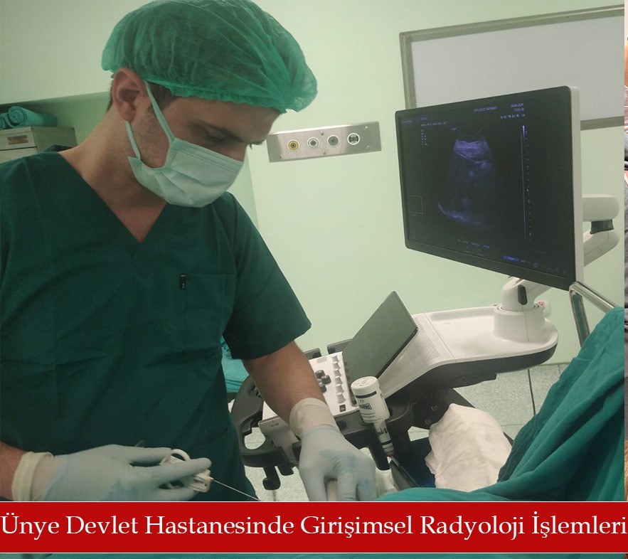 ÜNYE DEVLET HASTANESİNDE RADYOLOJİ İŞLEMLERİ YAPILMAYA BAŞLADI. DE